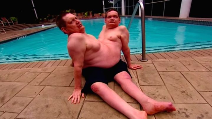 Cамые старые сиамские близнецы в мире 