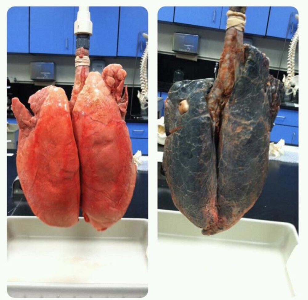На видео ученые в лаборатории наполняют воздухом две пары человеческих легких: здорового человека и курильщика.  В обоих случаях это довольно мерзкое зрелище. 