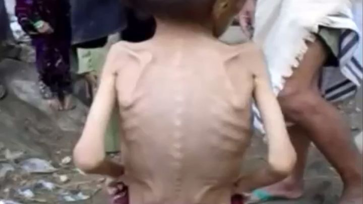 Ребёнок из Йемена 