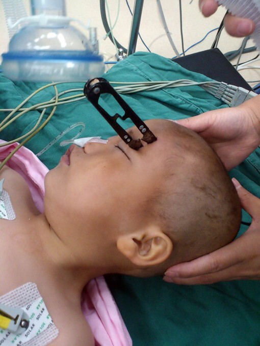 Малыш пробил голову ножницами