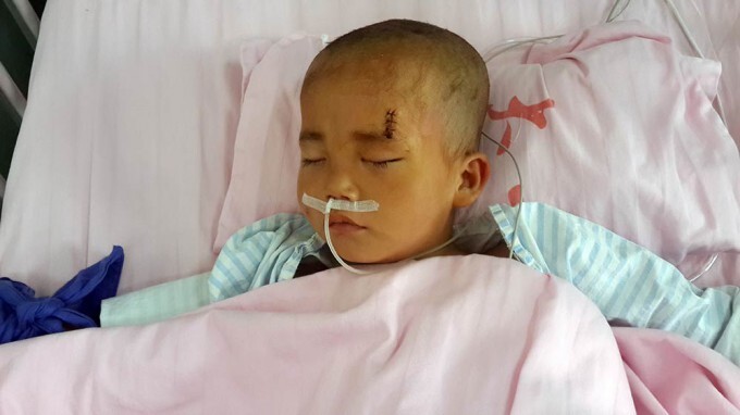 Малыш пробил голову ножницами