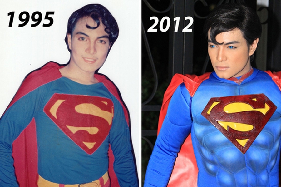 Мужчина с помощью пластических операций превратил себя в супермена