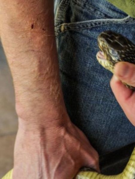 Американец выжил после сотни укусов ядовитых змей