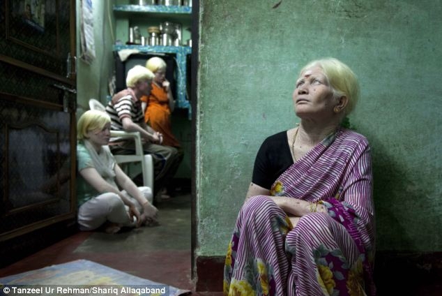 Самая большая семья альбиносов в мире из Индии