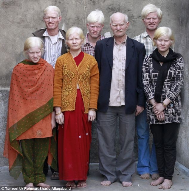 Самая большая семья альбиносов в мире из Индии