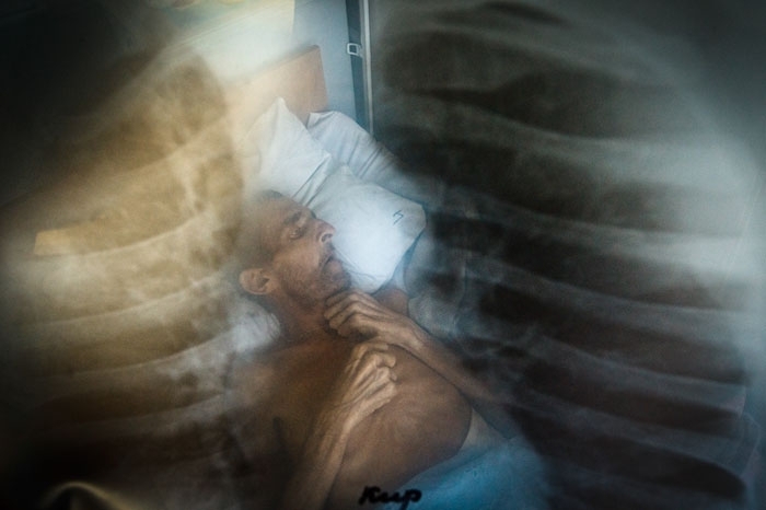 Нечеловеческие условия лечения больных туберкулезом