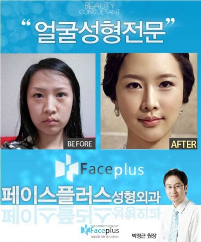 Пластическая хирургия в стиле "до и после"