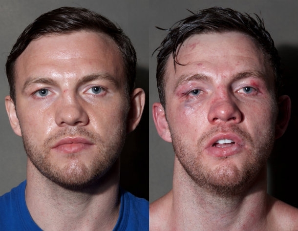 Боксеры до и после боя