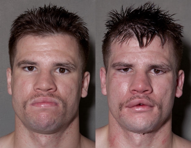 Боксеры до и после боя