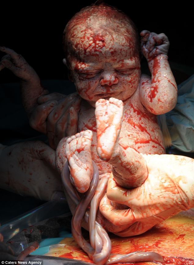Первое дыхание новорожденного младенца