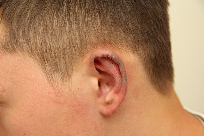 В Кузбассе мужики отрезали себе уши