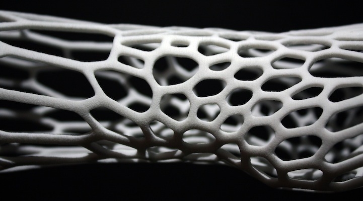 Новое в медицине - экзоскелетный гипс (3D-печать)