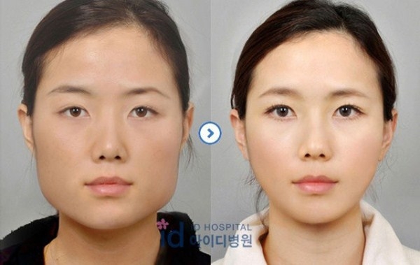 Пластическая хирургия в Южной Корее