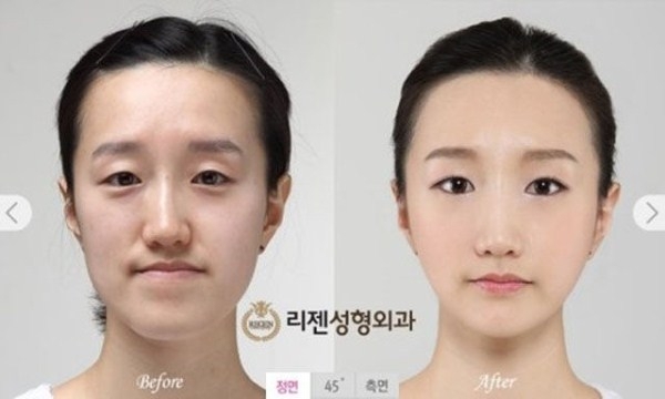 Пластическая хирургия в Южной Корее