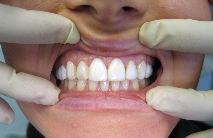 Чтобы первая медицинская помощь не оказалась последней: 10 опасных заб