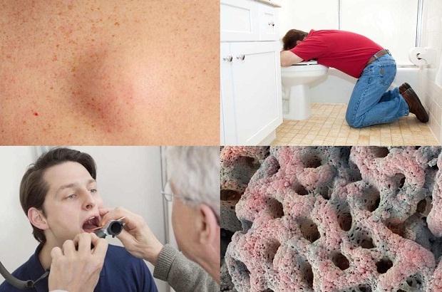10 самых отвратительных вещей в нашем теле