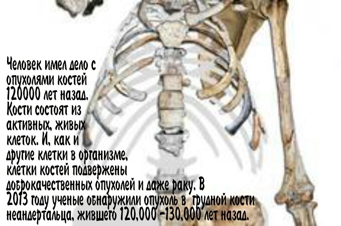 11 удивительных фактов о костях
