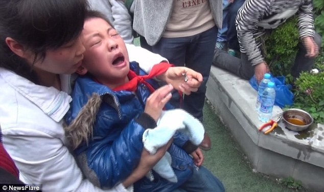 Как китайскому ребёнку снимали гайку с пальца