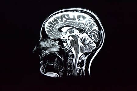Мозг мужчин и женщин устроен по-разному