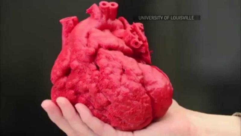 Ученые стремятся напечатать полностью функциональное человеческое сердце для пересадок 