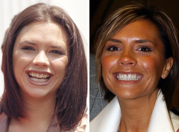 33 примера того, как зубы меняют внешность людей 