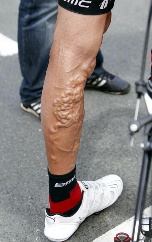 Ужасы велогонки Тур де Франс
