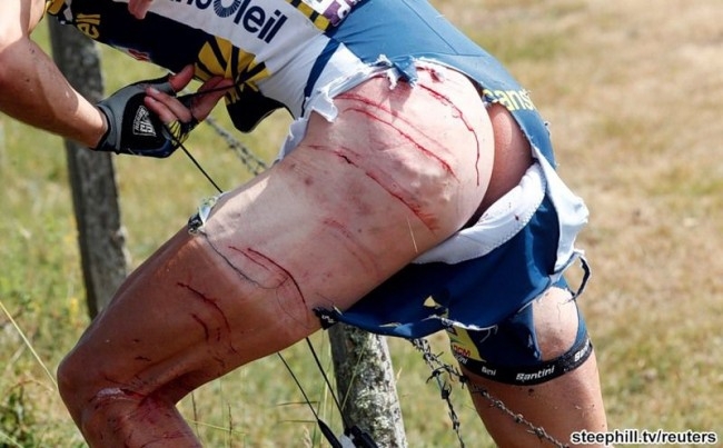 Ужасы велогонки Тур де Франс