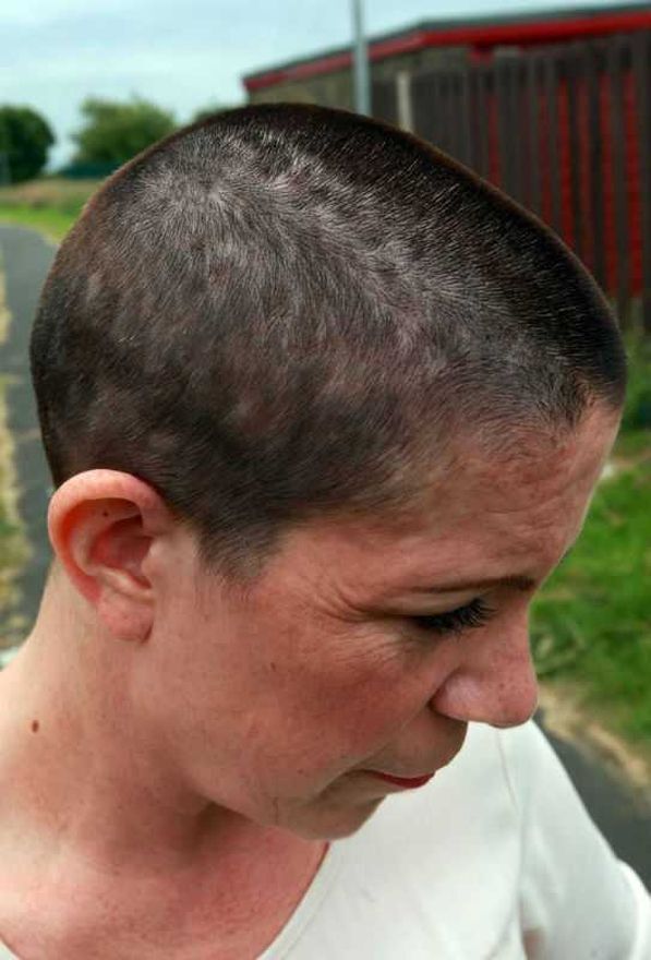 Домохозяйка осталась лысой после наращивания волос суперклеем