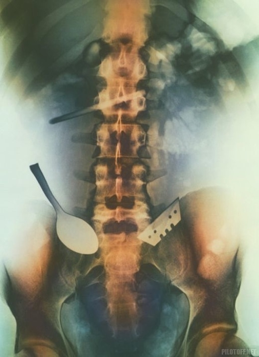 Страшные и нелепые снимки рентгена
