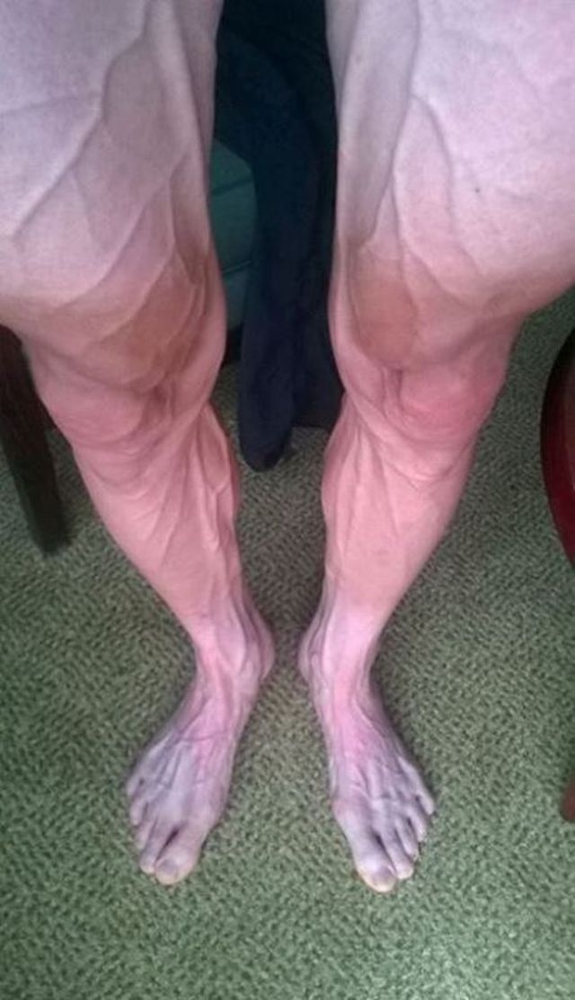 Как выглядят ноги профессионального велогонщика после гонки