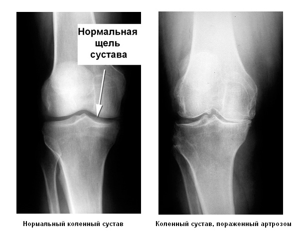 О спорт!!! Ты... Боль!!!