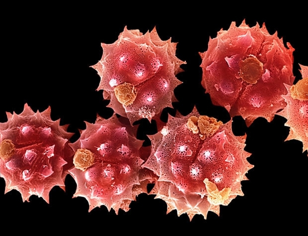 Частицы пыльцы и пыли под электронным микроскопом
