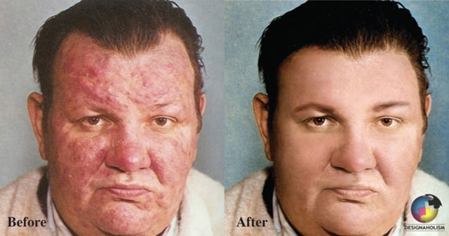 Фотографии людей до и после цифровой обработки