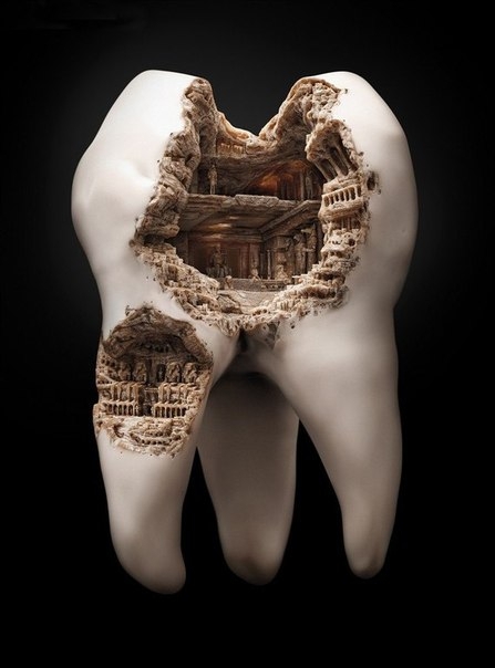 Колизей на зубе или как красиво показать кариес