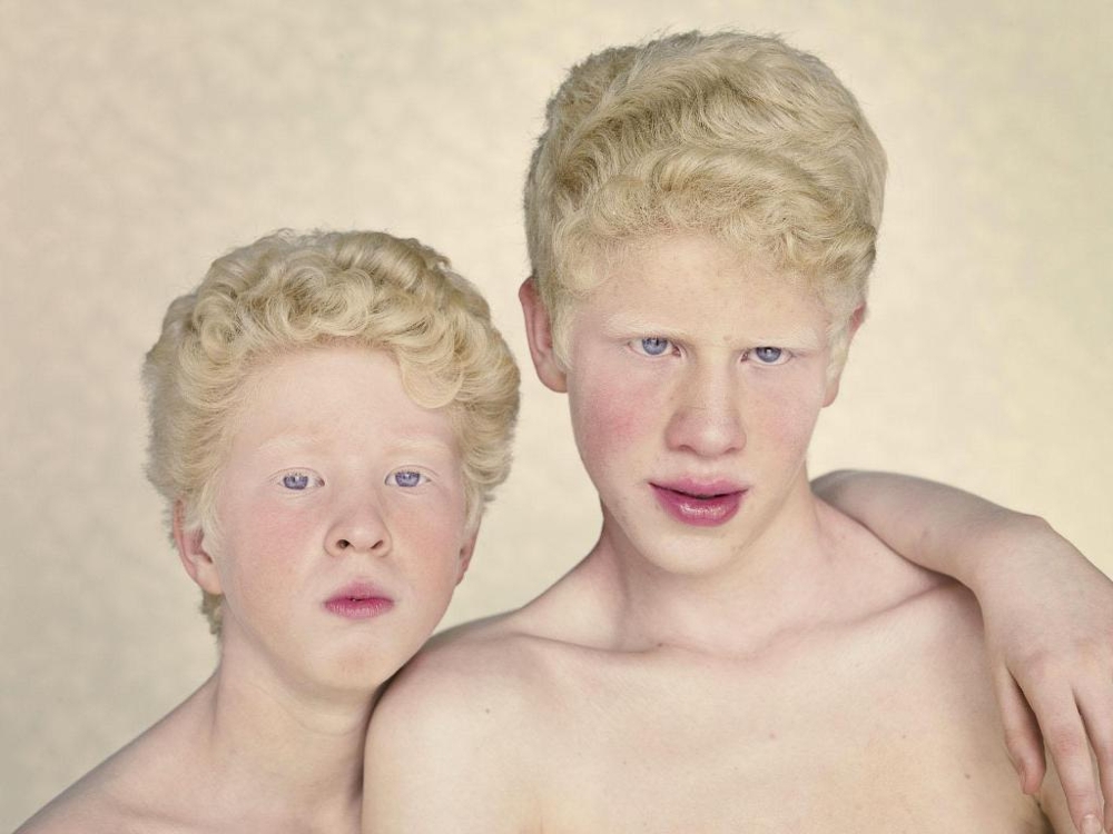 Не такие, как все: люди-альбиносы 