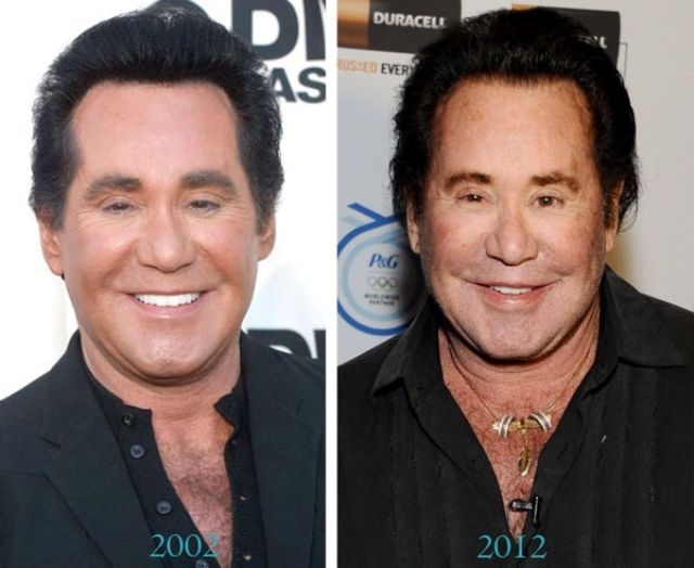 Голливудские знаменитости до и после пластических операций 