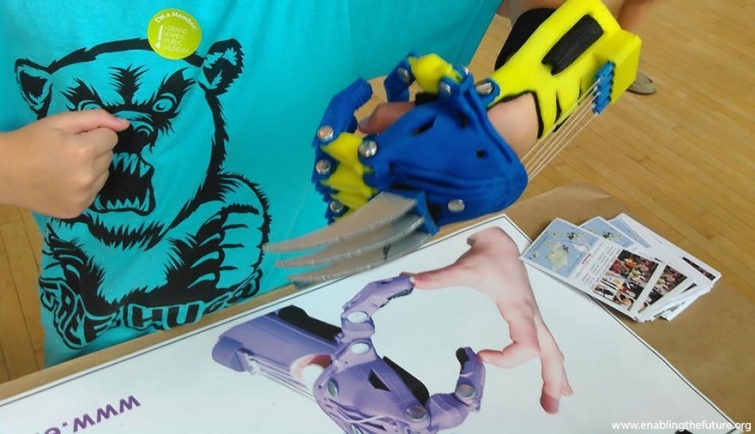 Удивительные детские 3D протезы  