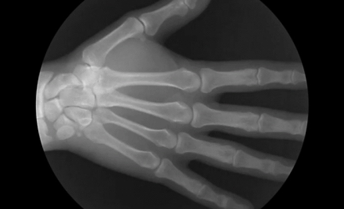 Гифки рентгеновских снимков, демонстрирующие движения костей 