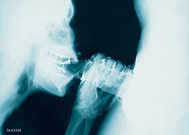 Не дышите! Самые любопытные рентгеновские снимки в истории человечеств
