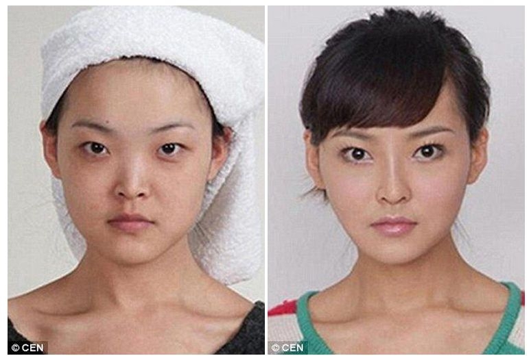Китаянки до и после пластических операций 