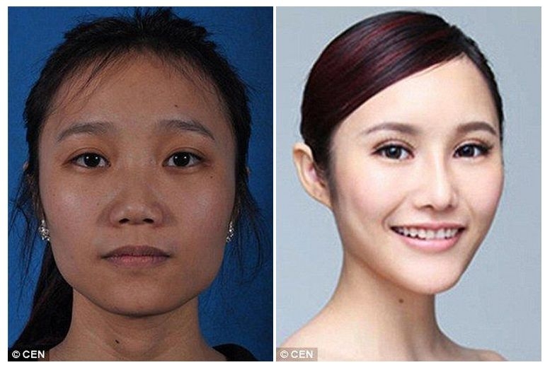 Китаянки до и после пластических операций 