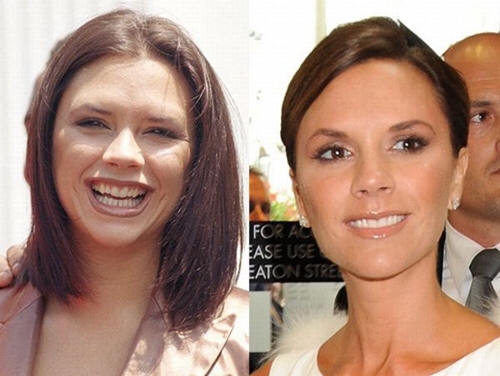 До и после стоматолога
