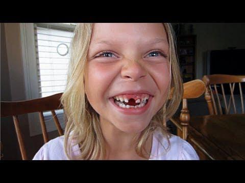Дети удаляют себе зубы 