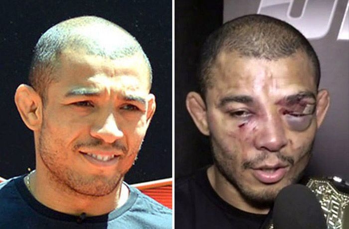 Лица бойцов UFC до и после боя