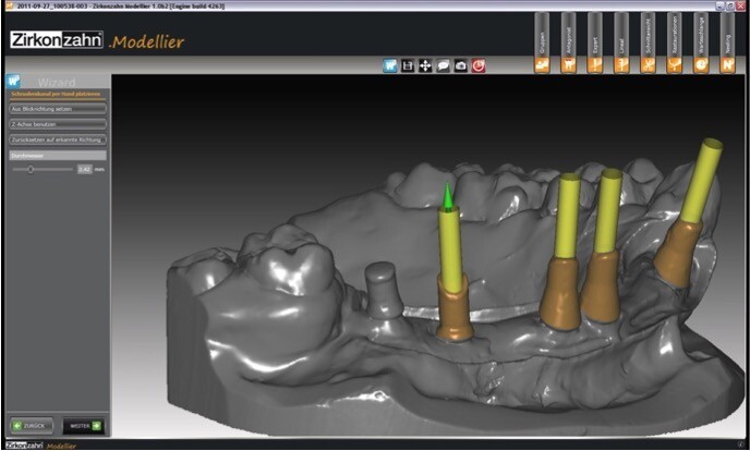 3D технологии на страже здоровья