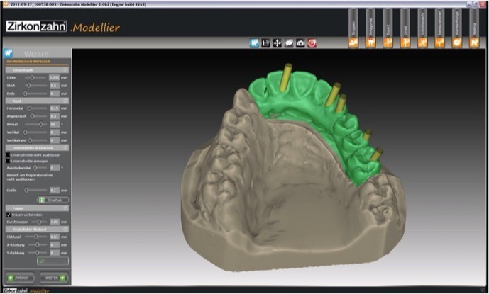 3D технологии на страже здоровья