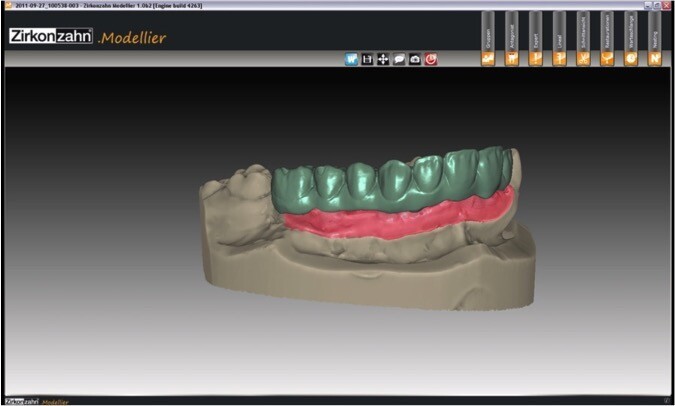 3D технологии на страже здоровья