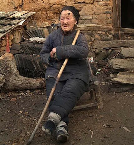 У столетней китайской бабушки растут рога  