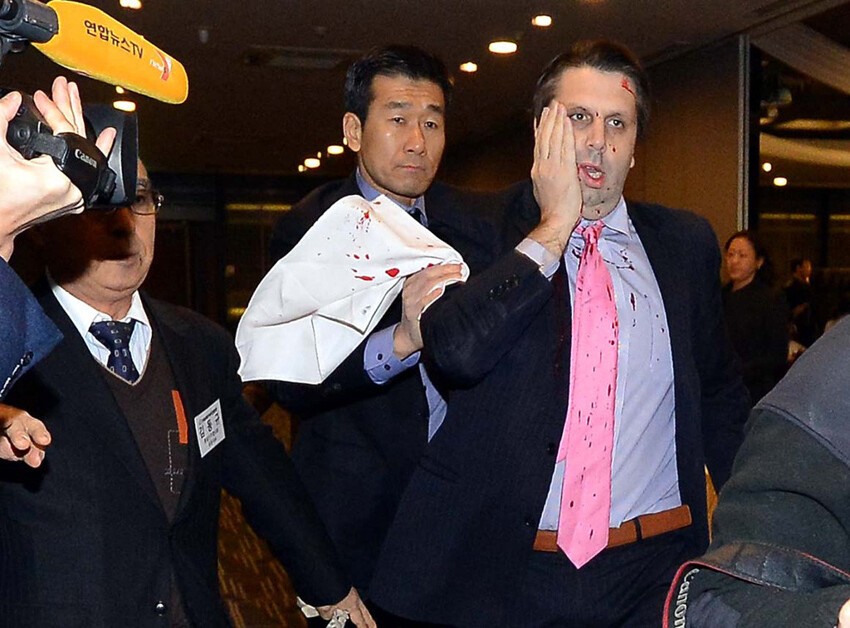 Посол США в Южной Корее пострадал за «подстрекательство»