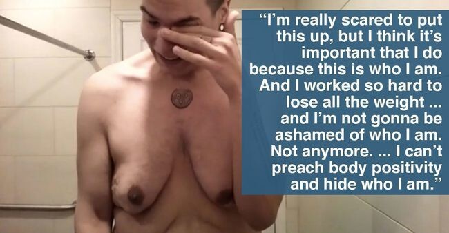 В дополнение к публикации своего смелого видео, Мэтт создал страницу на "GoFundMe", где все неравнодушные смогут перевести деньги на его пластическую операцию по удалению лишней кожи 
